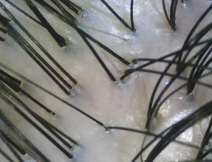 AFTER PURIFYING dry scalp opti AFTER PURIFYING dry scalp opti